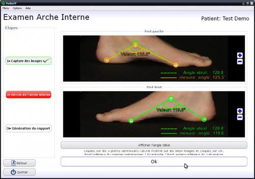 Internal_arch_photo_detection_GUI_fr-1