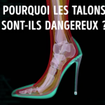 inconvénient du port des talons sur la posture